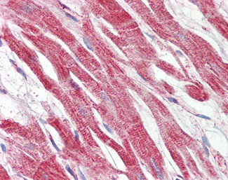 HAMP Antibody in Immunohistochemistry (Paraffin) (IHC (P))