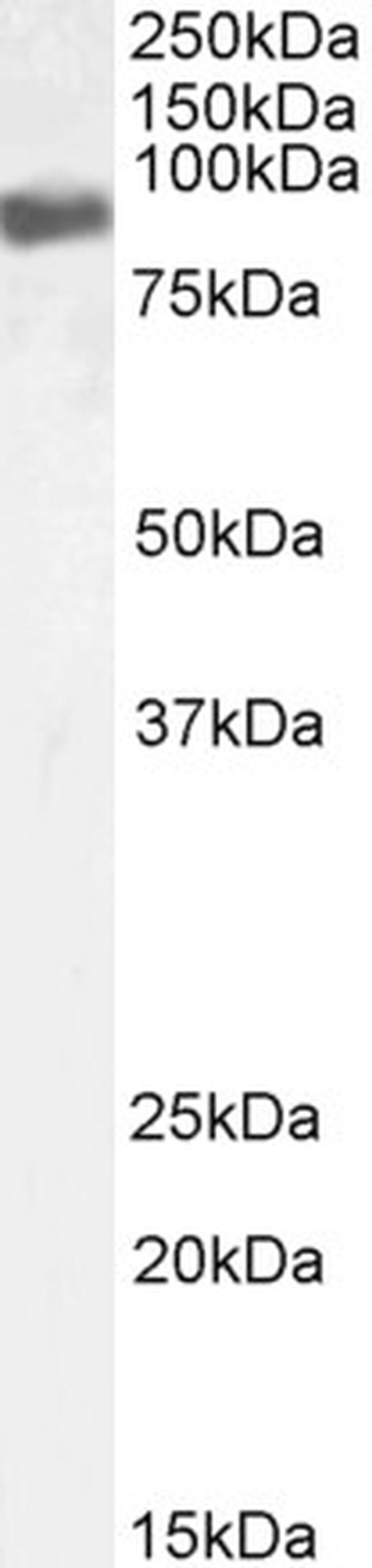 EWSR1 Antibody in Western Blot (WB)