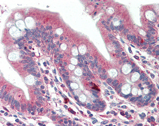 DTX2 Antibody in Immunohistochemistry (Paraffin) (IHC (P))