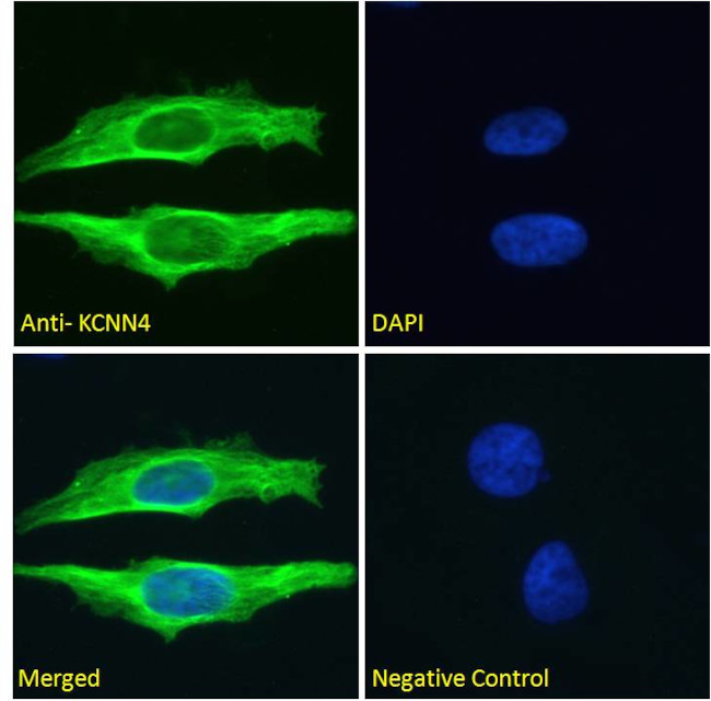 KCNN4 Antibody in Immunocytochemistry (ICC/IF)