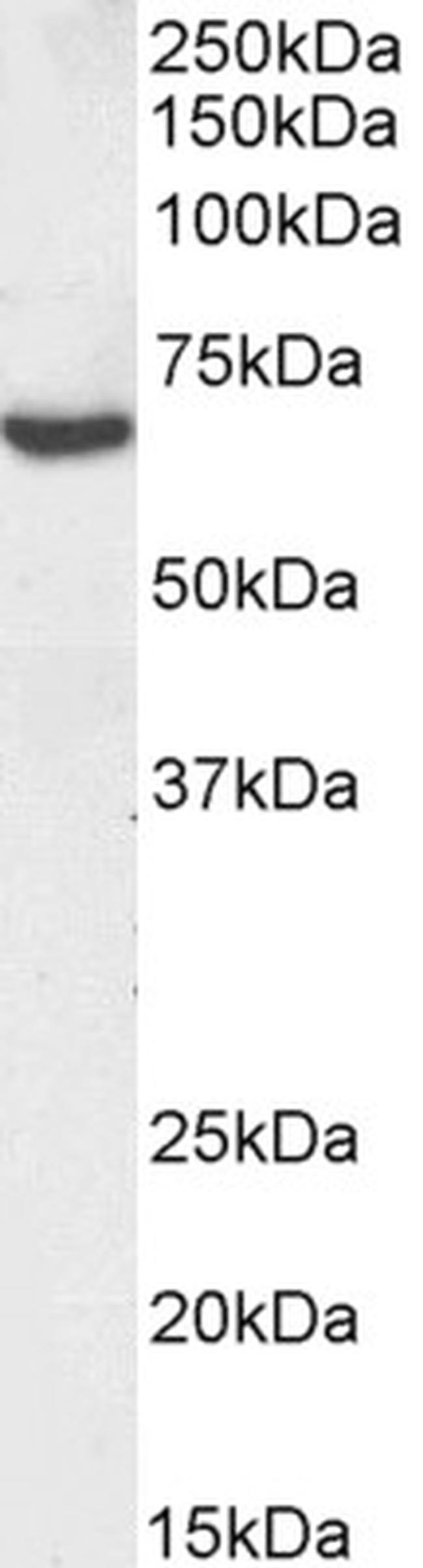 TGFBI Antibody in Western Blot (WB)