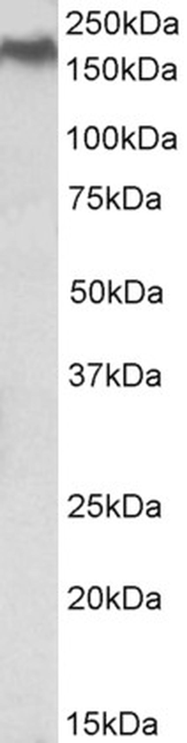 NPC1 Antibody in Western Blot (WB)