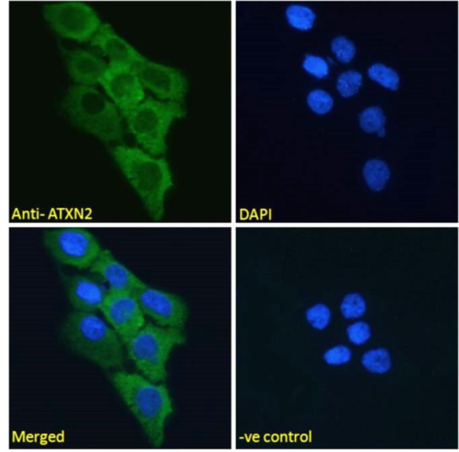 Ataxin 2 Antibody in Immunocytochemistry (ICC/IF)