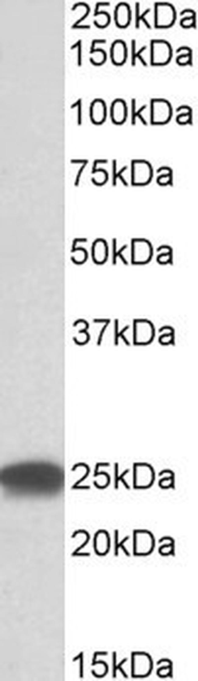 PSMB4 Polyclonal Antibody (PA5-142607)