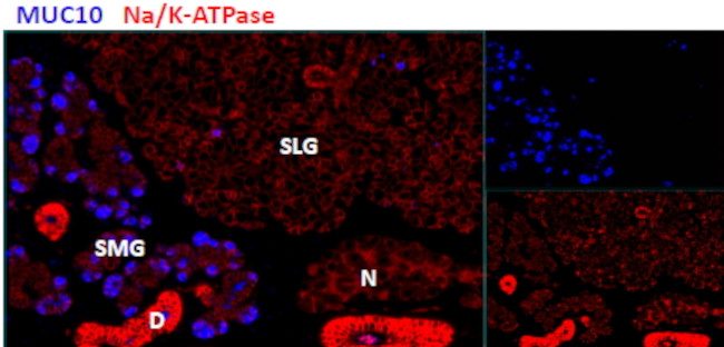 PROL1 Antibody in Immunohistochemistry (IHC)