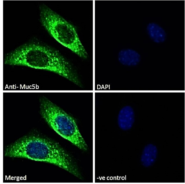 MUC5B Antibody in Immunocytochemistry (ICC/IF)