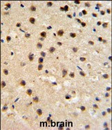 FKBP10 Antibody in Immunohistochemistry (Paraffin) (IHC (P))