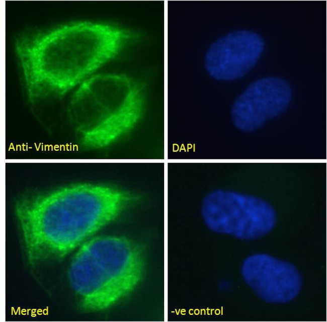 Vimentin Antibody in Immunocytochemistry (ICC/IF)