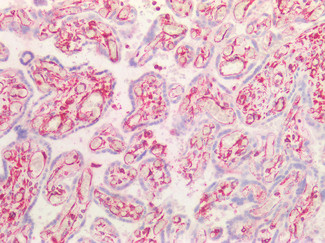 Vimentin Antibody in Immunohistochemistry (Paraffin) (IHC (P))