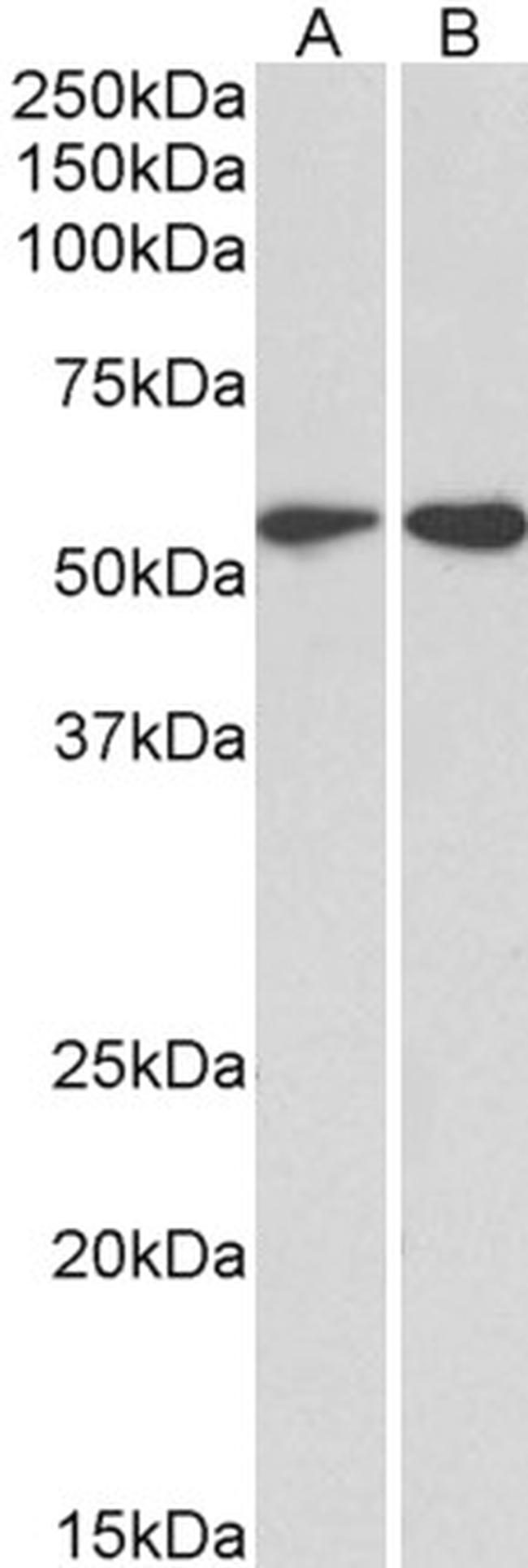 Vimentin Antibody in Western Blot (WB)