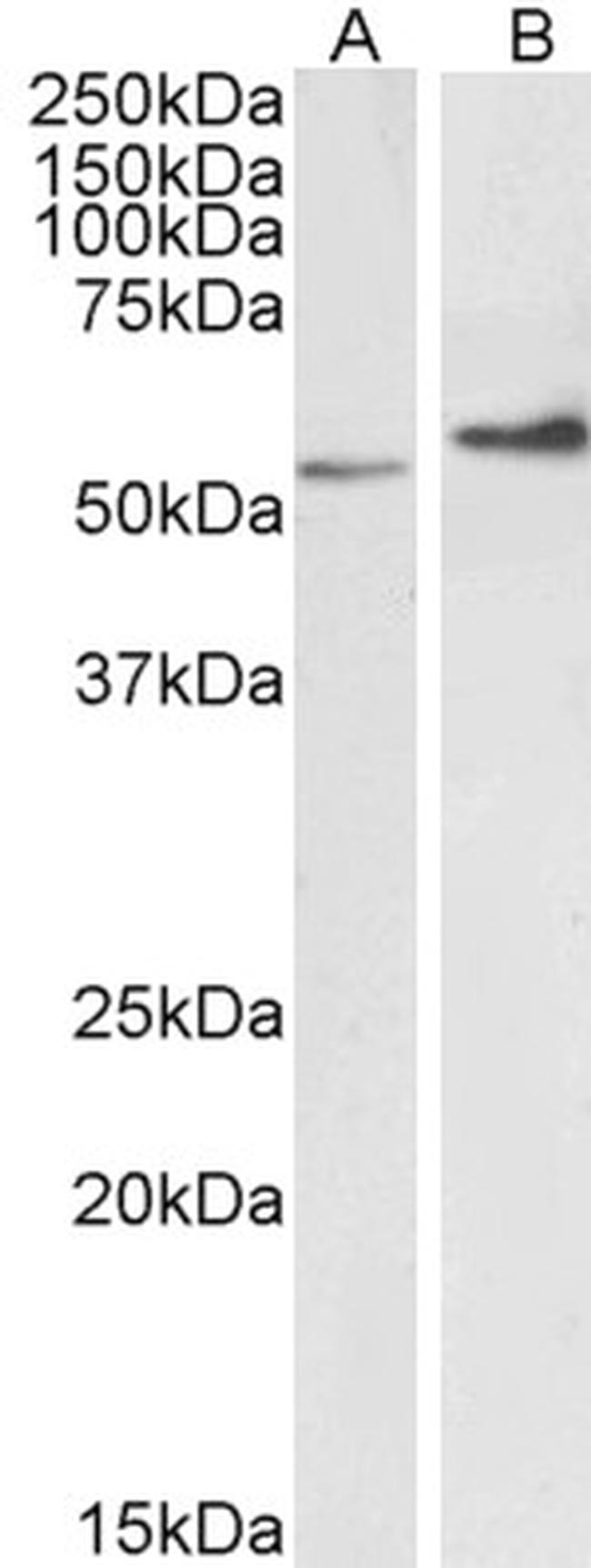 Vimentin Antibody in Western Blot (WB)