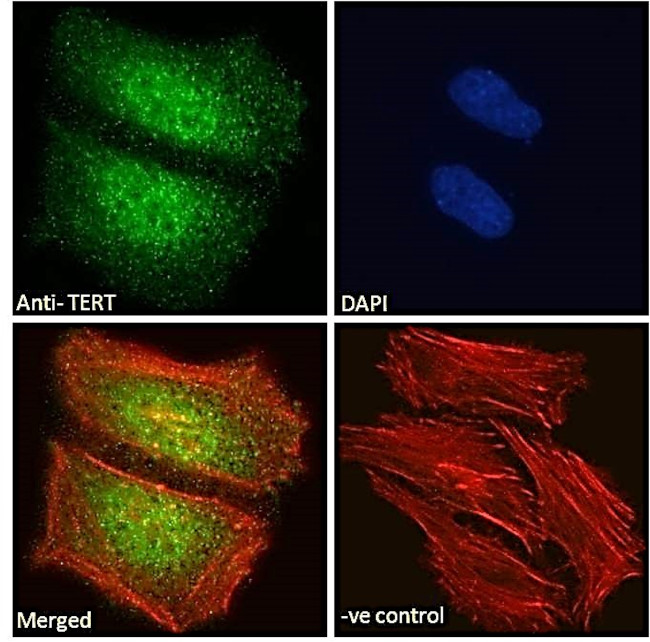 TERT Antibody in Immunocytochemistry (ICC/IF)