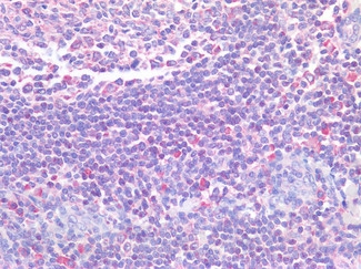 STAT5 alpha Antibody in Immunohistochemistry (Paraffin) (IHC (P))