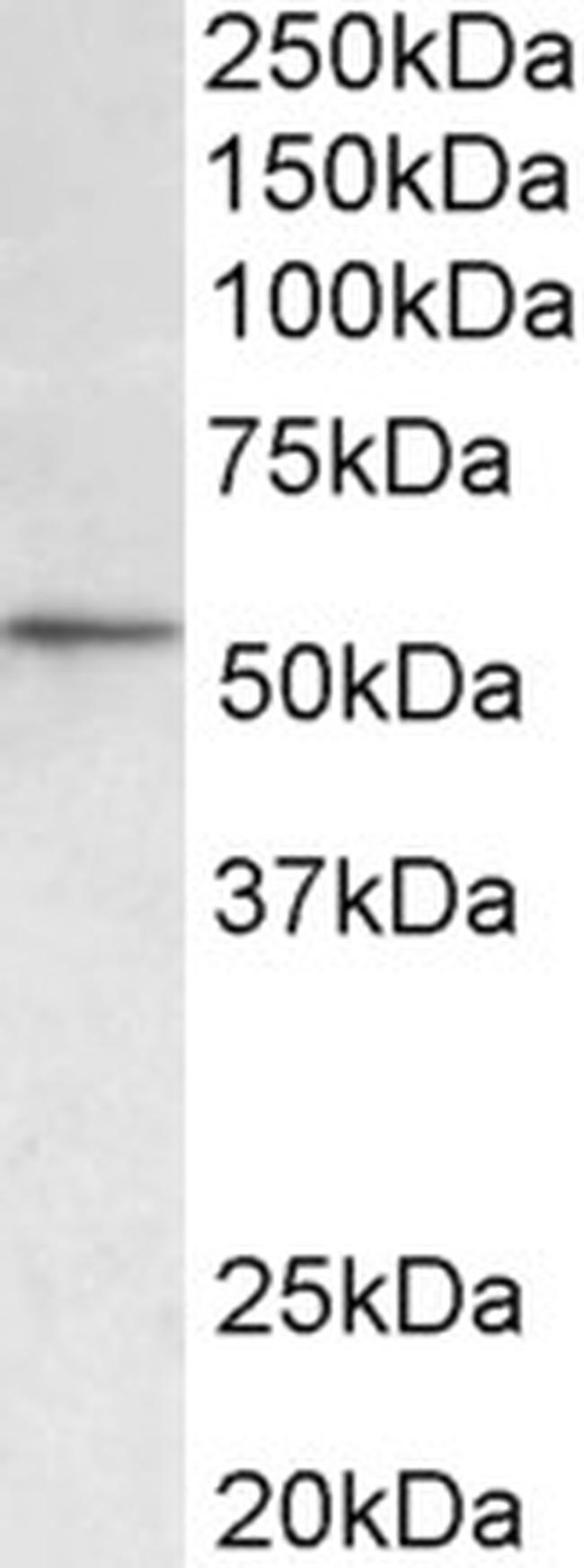 HDAC1 Antibody in Western Blot (WB)