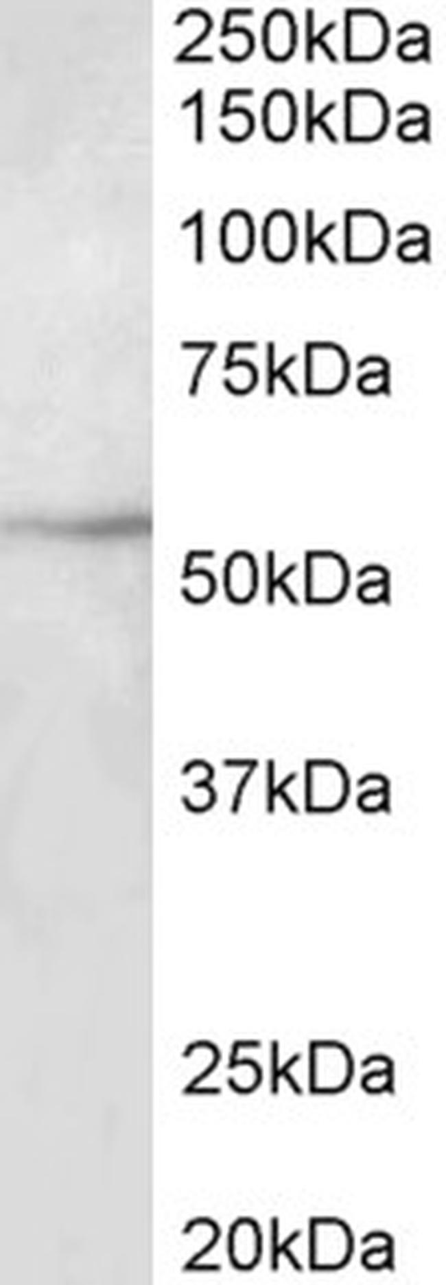 Beta III Tubulin Antibody in Western Blot (WB)