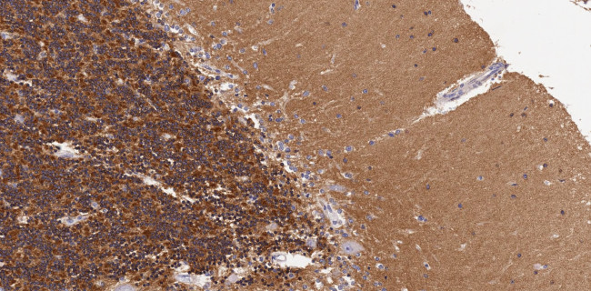 HTR2A Antibody in Immunohistochemistry (Paraffin) (IHC (P))