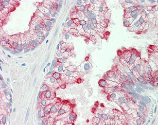 HRH3 Antibody in Immunohistochemistry (Paraffin) (IHC (P))