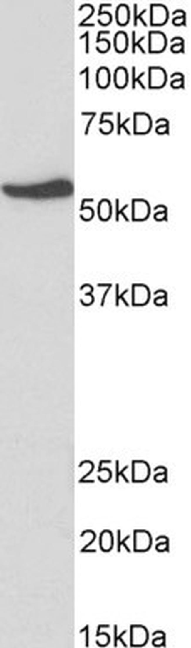 NR5A2 Antibody in Western Blot (WB)