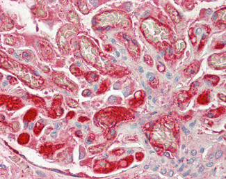 FIBB Antibody in Immunohistochemistry (Paraffin) (IHC (P))