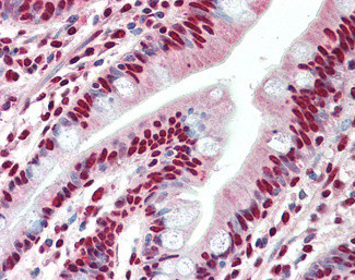 hnRNP A2B1 Antibody in Immunohistochemistry (Paraffin) (IHC (P))