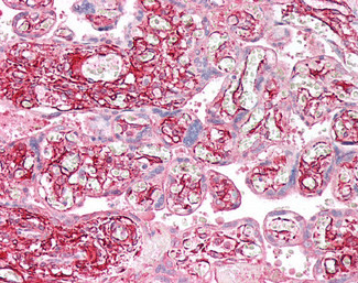 TPM4 Antibody in Immunohistochemistry (Paraffin) (IHC (P))