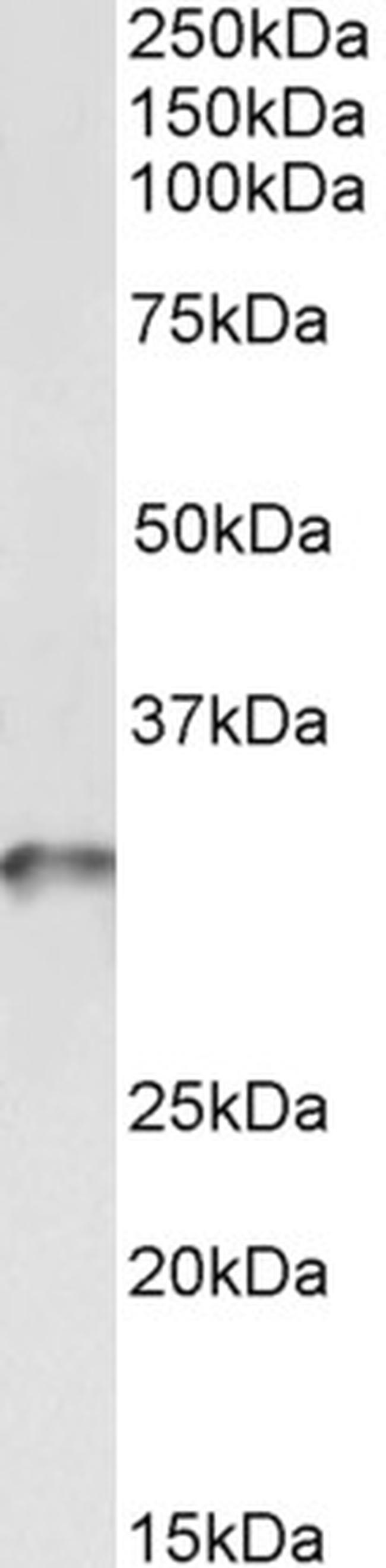 TPM4 Antibody in Western Blot (WB)