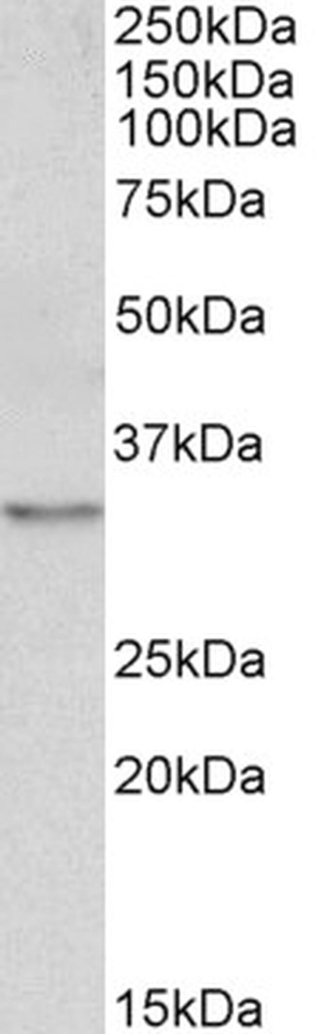 TPM4 Antibody in Western Blot (WB)