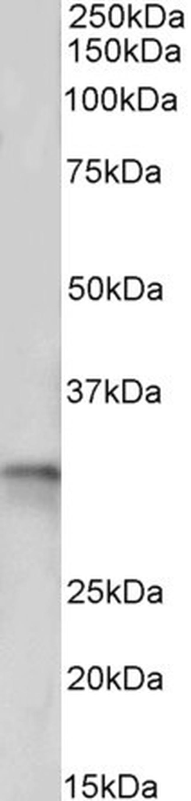 TPM4 Antibody in Western Blot (WB)