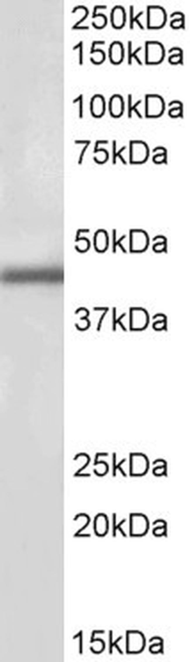 IP6K3 Antibody in Western Blot (WB)