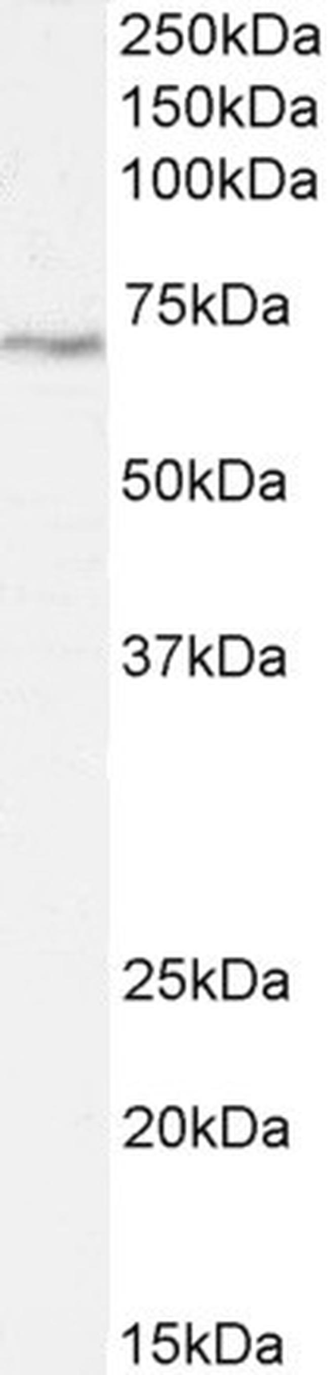 LIMK2 Antibody in Western Blot (WB)