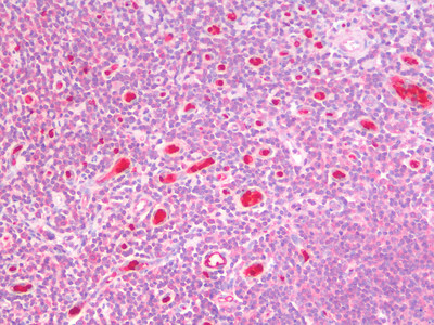 GSTM4 Antibody in Immunohistochemistry (Paraffin) (IHC (P))