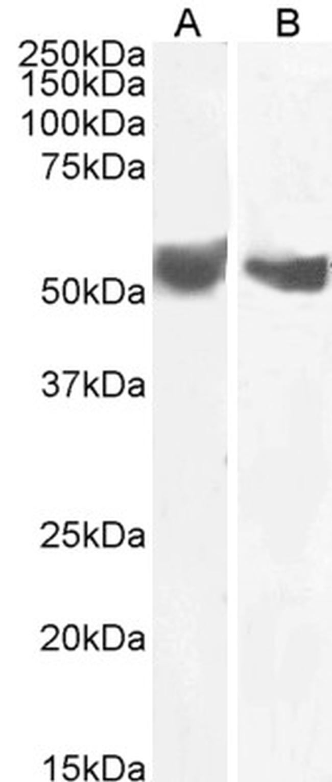 B7-H3 (CD276) Antibody in Western Blot (WB)