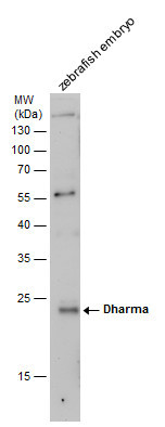 Dharma Antibody in Western Blot (WB)