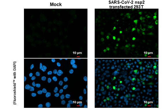 SARS-CoV-2 NSP2 Antibody in Immunocytochemistry (ICC/IF)