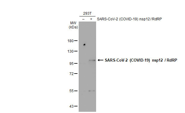 SARS-CoV-2 NSP12 Antibody in Western Blot (WB)