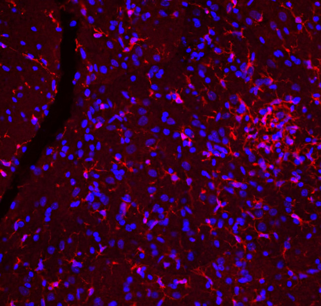 IBA1 Antibody in Immunohistochemistry (Paraffin) (IHC (P))