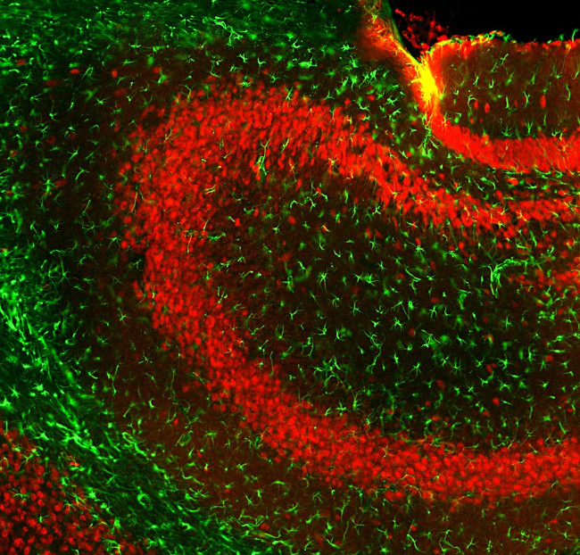 GFAP Antibody in Immunohistochemistry (PFA fixed) (IHC (PFA))