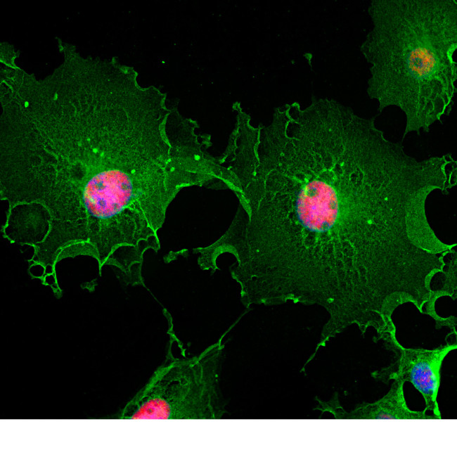 MECP2 Antibody in Immunocytochemistry (ICC/IF)