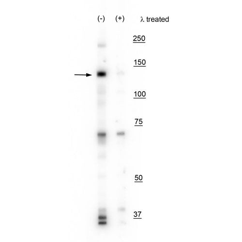 Phospho-IRE1 alpha (Ser724) Antibody in Western Blot (WB)