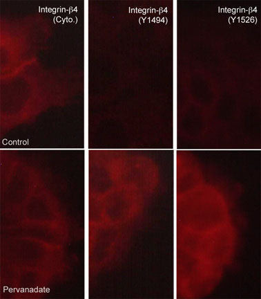 Phospho-CD104 Integrin beta 4 (Tyr1494) Antibody in Immunocytochemistry (ICC/IF)