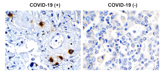 SARS-CoV-2 NSP7 Antibody in Immunohistochemistry (Paraffin) (IHC (P))
