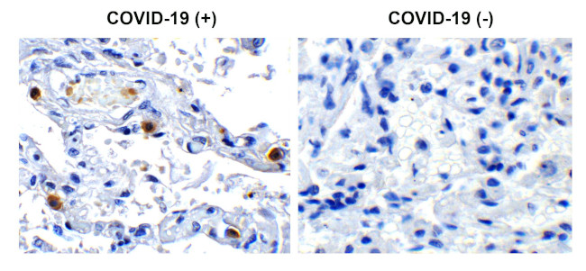 SARS-CoV-2 NSP16 Antibody in Immunohistochemistry (Paraffin) (IHC (P))