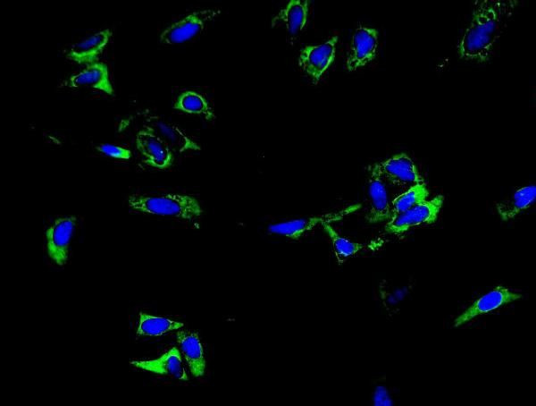 TRIM6 Antibody in Immunocytochemistry (ICC/IF)