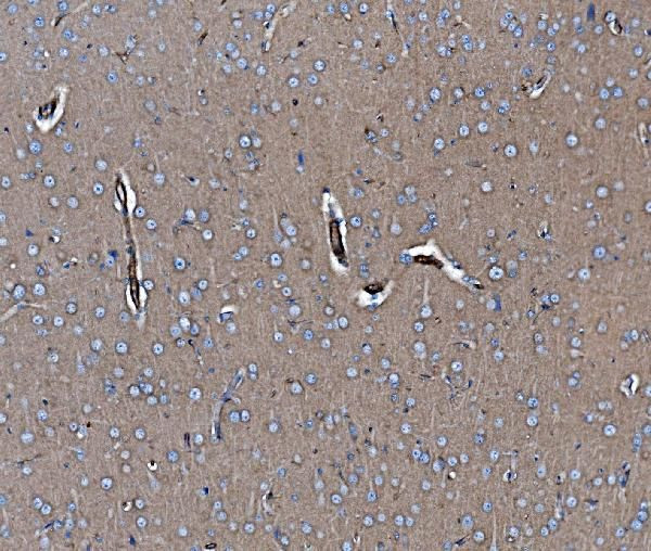 EHD3 Antibody in Immunohistochemistry (Paraffin) (IHC (P))