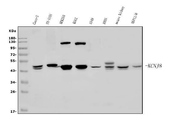 Kir6.1 (KCNJ8) Antibody in Western Blot (WB)