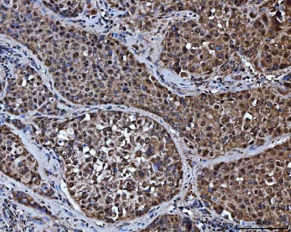 RG9MTD1 Antibody in Immunohistochemistry (Paraffin) (IHC (P))