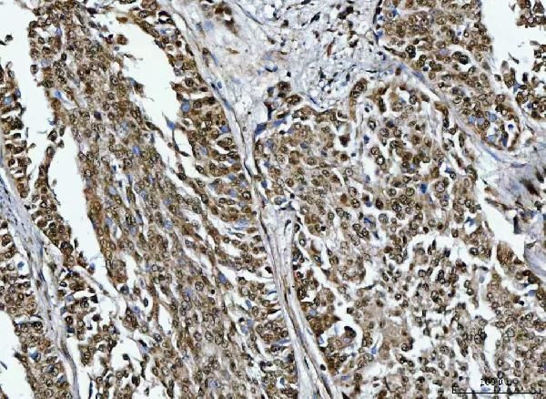 RG9MTD1 Antibody in Immunohistochemistry (Paraffin) (IHC (P))