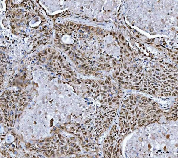 RG9MTD1 Antibody in Immunohistochemistry (Paraffin) (IHC (P))