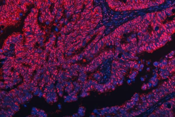 RG9MTD1 Antibody in Immunohistochemistry (Paraffin) (IHC (P))