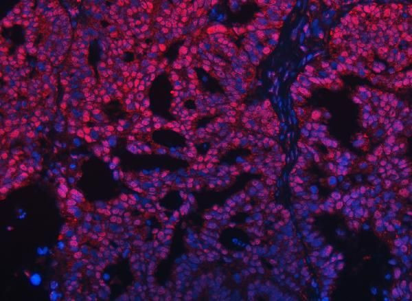 RG9MTD1 Antibody in Immunohistochemistry (Paraffin) (IHC (P))